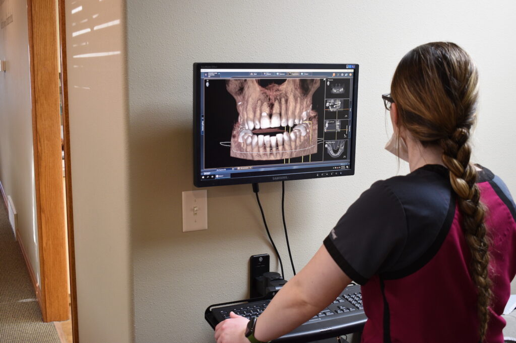 Dental X Ray Analysis